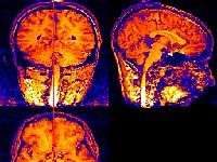 Sóng não có thể kiểm soát robot Sóng não có thể kiểm soát robot