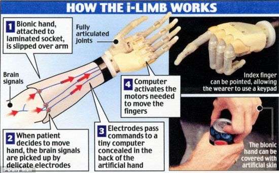 Kỳ diệu bàn tay giả i-limb ultra