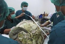 Mổ lấy gần nghìn đồng xu trong bụng rùa biển Thái Lan