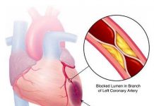 Thiết bị Kardiosens cảnh báo sớm nhồi máu cơ tim Thiết bị Kardiosens cảnh báo sớm nhồi máu cơ tim