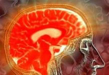 Cảm biến từ trường siêu nhạy mới cho phép nghiên cứu não dễ dàng hơn Cảm biến từ trường siêu nhạy mới cho phép nghiên cứu não dễ dàng hơn