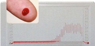 Xét nghiệm máu cực nhanh với thiết bị mới