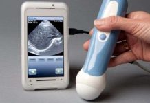 Máy quét siêu âm trong điện thoại thông minh Máy quét siêu âm trong điện thoại thông minh