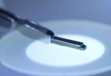 Chip cấy ghép hỗ trợ smartphone dự đoán cơn đau tim