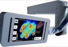 Thiết bị mới đo lưu lượng máu cho bệnh nhân bỏng