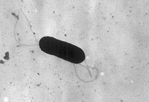 Thiết bị phát hiện nhanh vi khuẩn gây ngộ độc thực phẩm