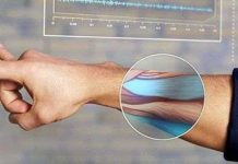 Vòng tay "siêu nhân"