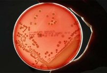 Phát hiện điểm yếu của “siêu vi khuẩn” kháng thuốc