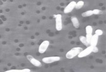 Vi khuẩn có thể sống trong môi trường thạch tín