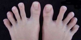Đố bạn phân biệt 3 ngón chân bất trị ai cũng có