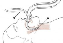 Flex - Robot rắn chui vào cơ thể qua đường miệng để phẫu thuật