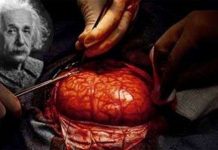 Chuyện lạ có thật về bộ não con người