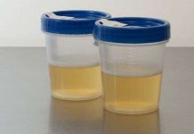 Phát minh mới có thể biến nước tiểu thành điện năng