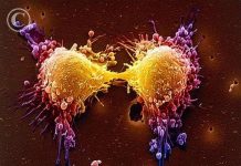 5 biến thể gen liên quan tới ung thư tiền liệt tuyến