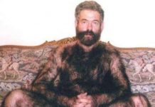 Nam giới ở đâu nhiều lông nhất thế giới?