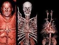 Thiết bị X quang 'đúp' tăng gấp đôi tốc độ chụp