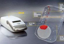 Thiết bị phát hiện HIV trong 15 phút