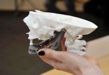 Máy in 3D "đúc" xương hàm cho cụ bà 83 tuổi