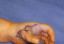 Xem cách các chuyên gia nhận biết danh tính người chết