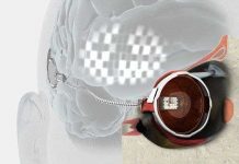 Mắt điện tử: thêm hy vọng sáng mắt cho người mù