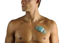 Phát hiện loạn nhịp nhờ thiết bị tí hon