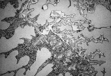 Cấu trúc kì diệu bên trong giọt nước mắt con người