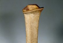 Những đôi giày cao tới 50cm: Chuẩn mực của cái đẹp phụ nữ thời Trung Đại