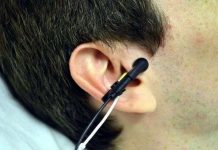 Cải thiện sức khỏe tim mạch nhờ kích điện lỗ tai