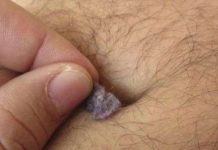 Sự thật bất ngờ về thứ cặn "siêu bẩn" trong rốn mà không phải ai cũng có