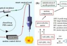 Công nghệ SMART - Bước tiến lớn trong phẫu thuật y học