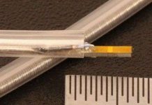 Thiết bị siêu âm mới phát hiện sớm bệnh trụy tim