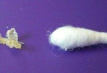 Tại sao con người có ráy tai