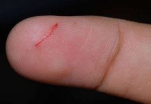 Vì sao đứt tay do giấy cứa đau hơn cả dao?