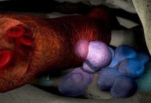 Phát hiện phân tử giúp trích xuất tế bào gốc phục vụ chữa trị ung thư máu Phát hiện phân tử giúp trích xuất tế bào gốc phục vụ chữa trị ung thư máu