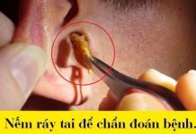 Biết người Hy Lạp cổ sống "quái dị" thế này, bạn sẽ thầm cảm ơn vì đang sống ở thế kỷ 21