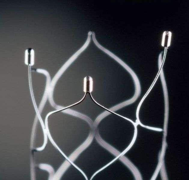 Solitaire – Đột phá mới trong điều trị đột quị