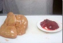 "Mặt trái" của món ăn hàng đầu nước Pháp khiến ai cũng phải suy ngẫm