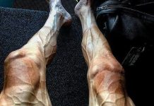 Lý do khiến chân của vận động viên đua xe đạp biến dạng khủng khiếp