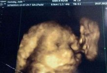 Ông cố đã mất xuất hiện trong ảnh siêu âm của chắt