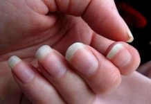 Nguyên nhân móng tay mọc nhanh hơn móng chân