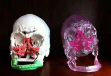 Phẫu thuật chấn thương mặt bằng công nghệ 3D