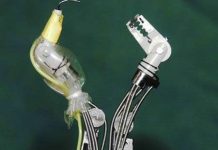 Robot "cua" giúp cắt sạch mô ung thư dạ dày