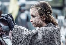 Nguồn gốc thật của căn bệnh thạch nhân đáng sợ trong "Trò chơi vương quyền"