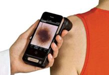 Dùng điện thoại chẩn đoán khối u