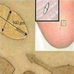 Robot siêu nhỏ dùng cho phẫu thuật