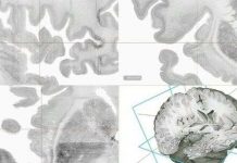 Thiết lập mô hình 3D đầu tiên của bộ não người