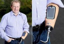 Lắp ghép điện thoại vào cánh tay giả