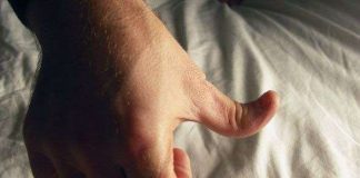 Những điều ít biết về người có ngón tay cái bẻ ngược