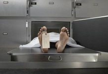 Cách khám nghiệm tử thi mới không cần mổ xác chết