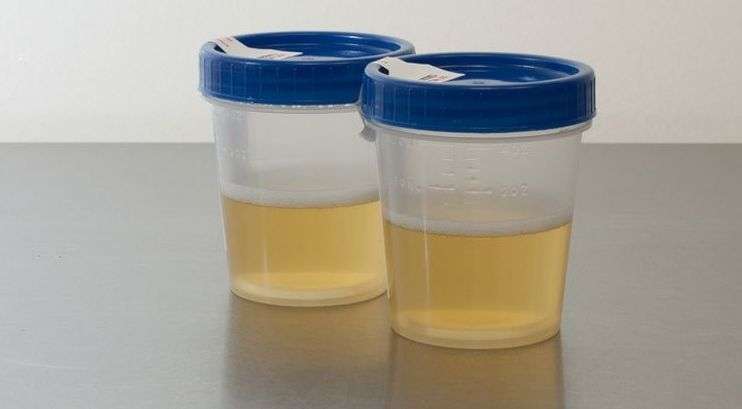 Phát minh mới có thể biến nước tiểu thành điện năng